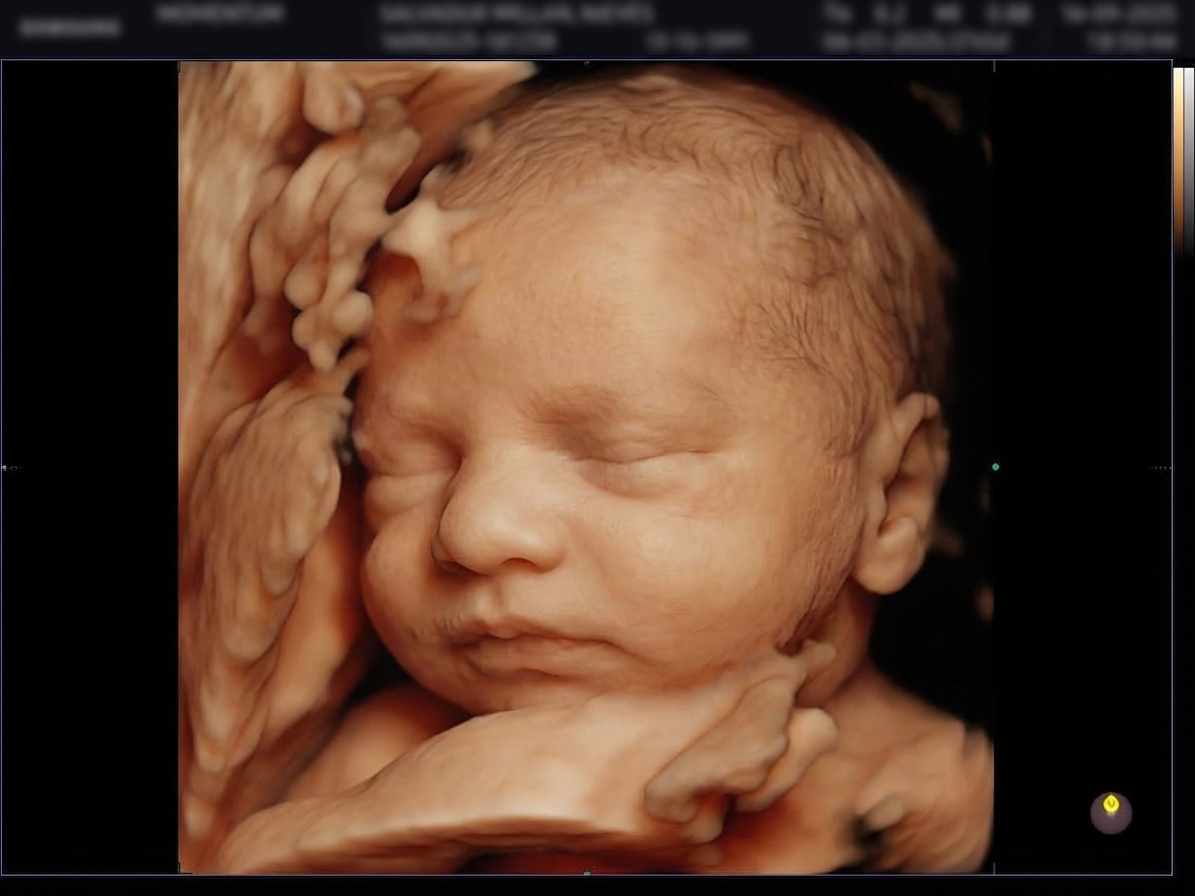 Cara del bebé mejorada con IA desde ecografía — BabyFaceReveal