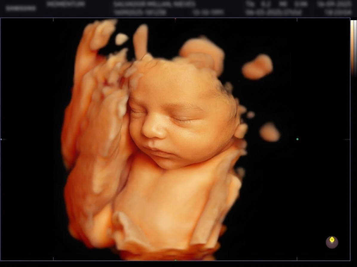 Cara del bebé mejorada con IA desde ecografía 3D — BabyFaceReveal