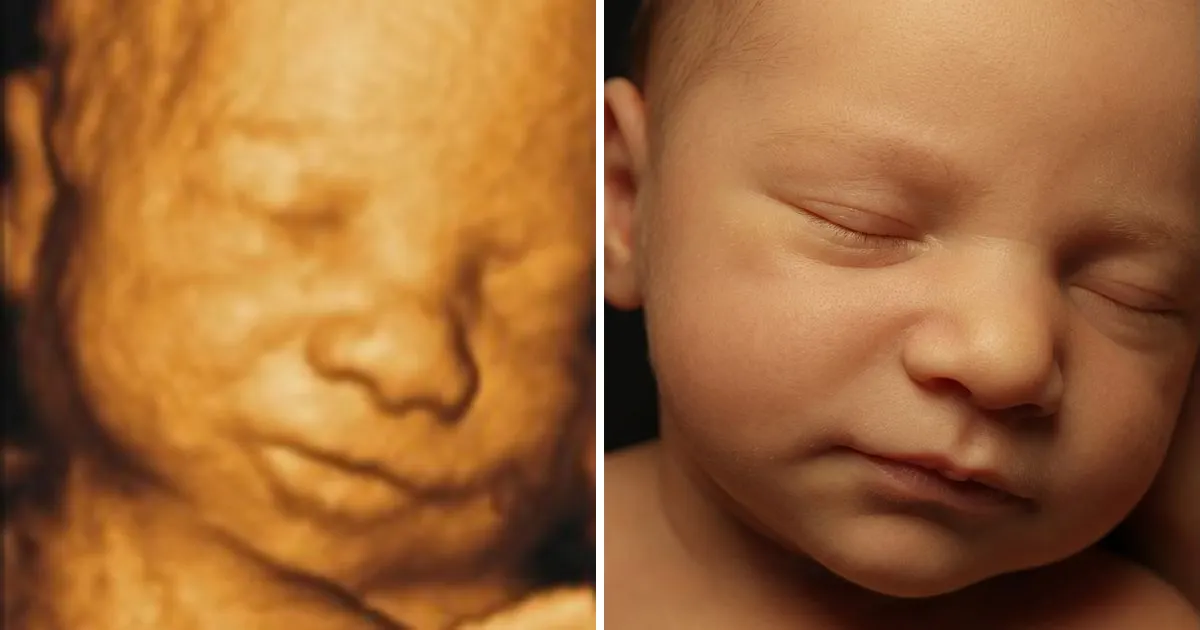 3D ultrasound next to the realistic baby portrait created from it