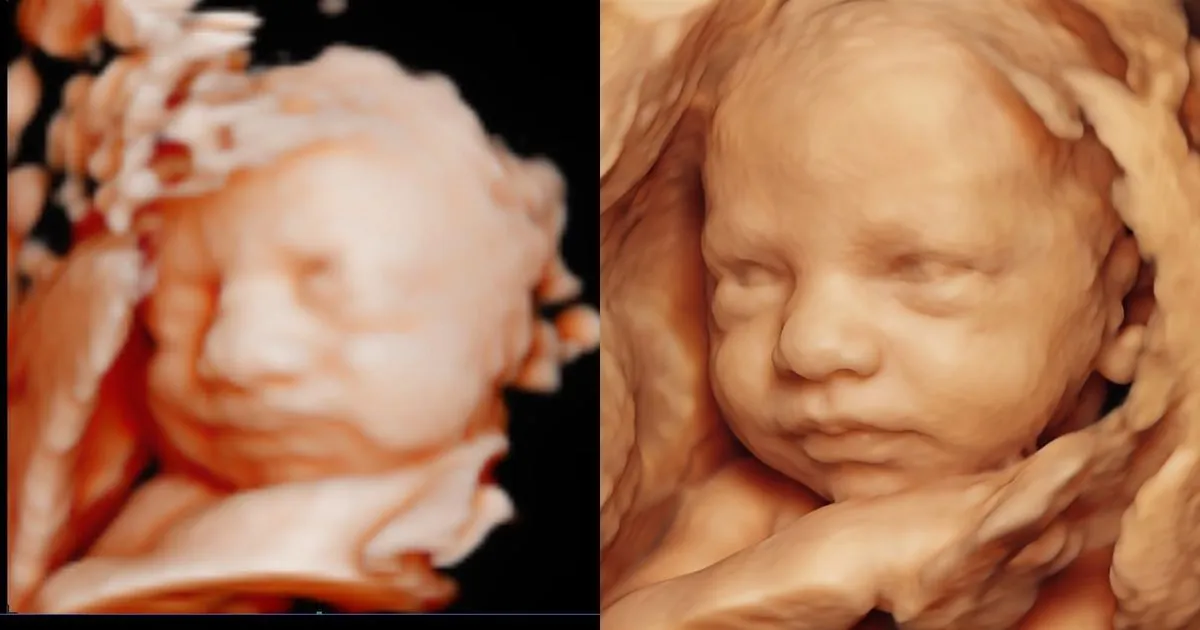 Ecografía 3D de un bebé junto al retrato hiperrealista que se entrega a los padres