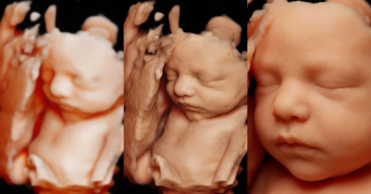 Ecografía 5D de un bebé con las manos cerca de la cara y sus versiones Detallada y Creativa