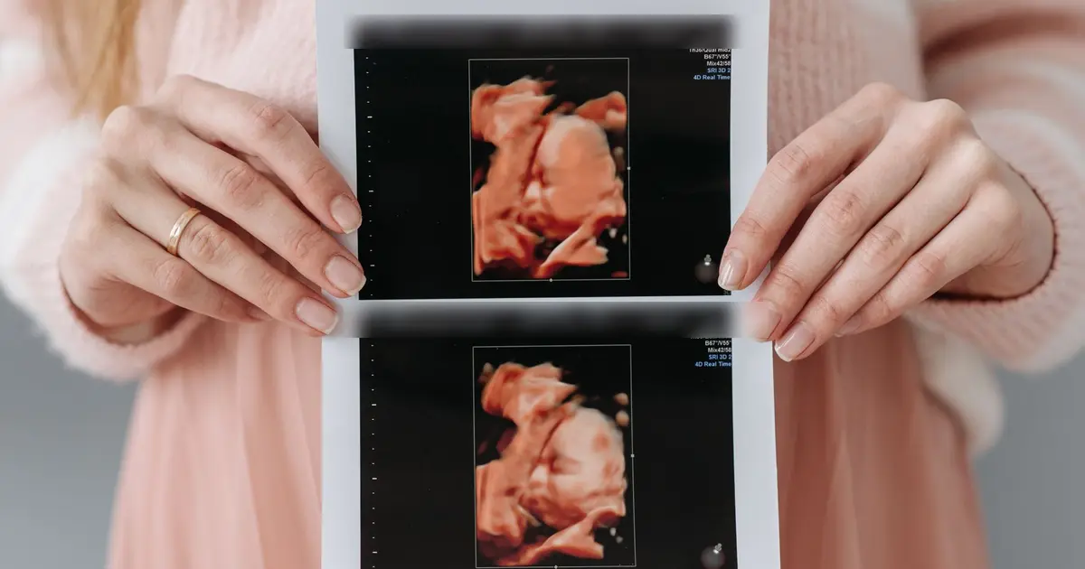 Mãos segurando a impressão de um ultrassom 3D de um bebê