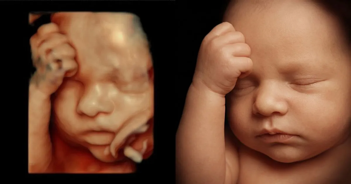5D ultrasound of a baby with a hand on the forehead next to a hyperrealistic portrait created from it