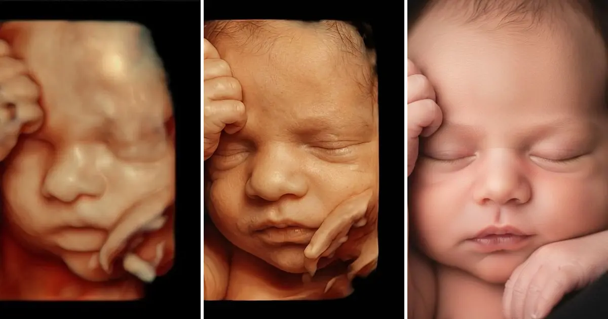 3D ultrasound, its 8K enhancement and the realistic portrait created from it